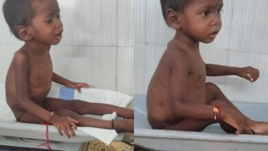 सेवा की कहानी : पोषण पुनर्वास केंद्र से लौट रही बच्चों के चेहरे की मुस्कान….. सेवा की कहानी : पोषण पुनर्वास केंद्र से लौट रही बच्चों के चेहरे की मुस्कान…..